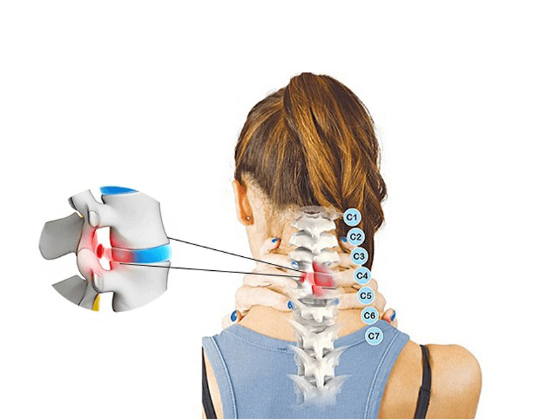 phuong-phap-nao-chua-thoat-vi-cot-song-co