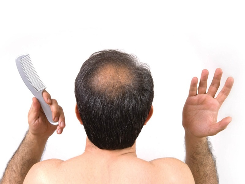 thuoc-tri-rung-toc-anh-huong-den-ban-linh-dan-ong