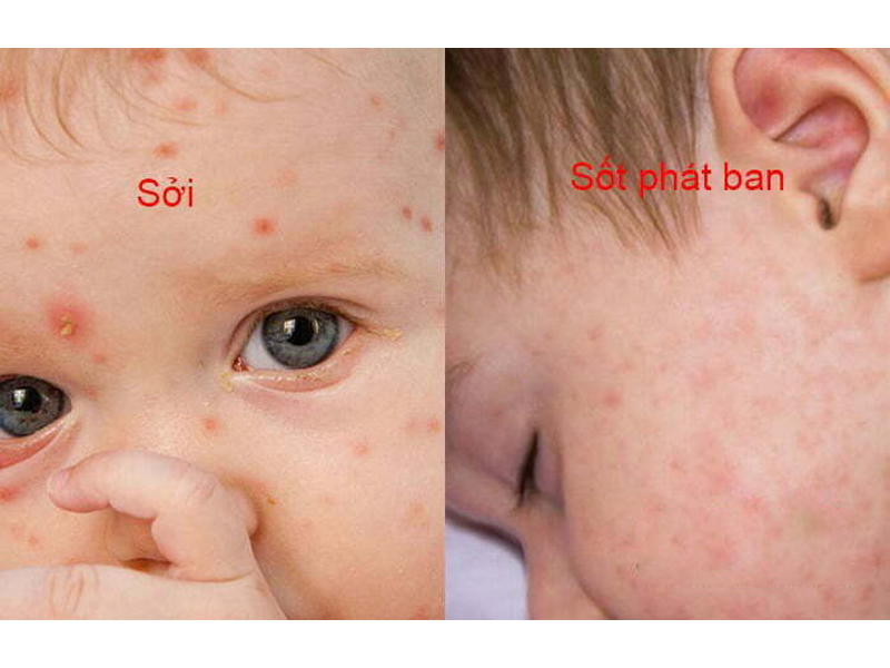 ban-soi-va-sot-phat-ban
